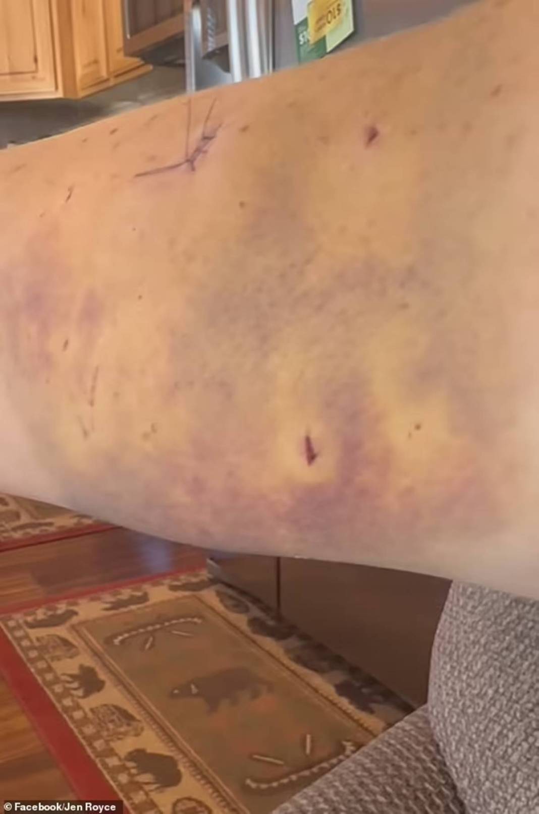 Nehre girdi, kanlar içinde çıktı! O canavar yüzünü paramparça etti... Arkasından usulca gelip... 4